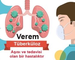 Her 22 saniyede 1 kişi veremden hayatını kaybediyor!