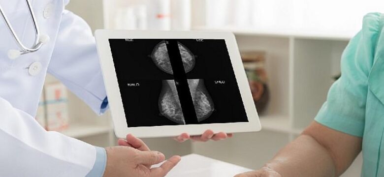 Mamografinizin sonucunun şüpheli olması ne anlama gelir?