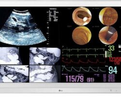 LG Monitörler Cerrahi Operasyonlarda Doktorlara Destek Oluyor