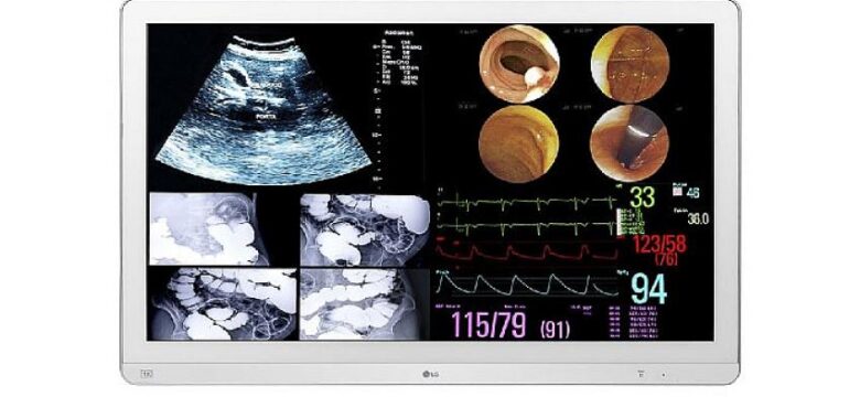 LG Monitörler Cerrahi Operasyonlarda Doktorlara Destek Oluyor