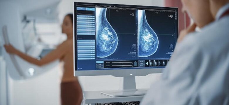 Mamografi Taramasını Atlamak Hayati Risk Oluşturabiliyor!
