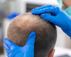 Medikal Estetik Uygulamaları Saç Problemlerini Ortadan Kaldırıyor