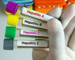 Hepatitte Aşılama Kronik Enfeksiyonları Önlemede %95 Etkili